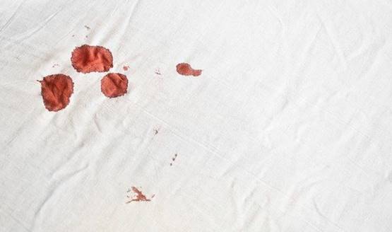 Ciri-Ciri Perut Hamil Dan Perut Buncit Perut Hamil Disertai Pendarahan Ringan